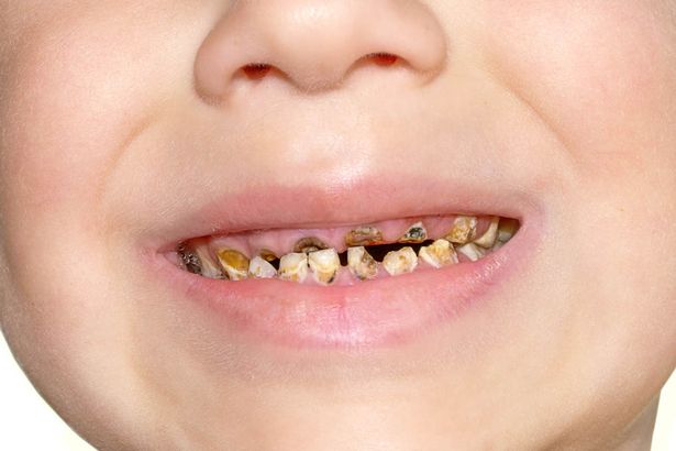 featured-image