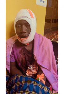 Musanze : Umuturage arembeye mu Bitaro nyuma yo gukomeretswa n'imbogo