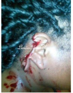 Uganda: Umugabo yaciye amatwi y'umugore we amuziza kutamwumva