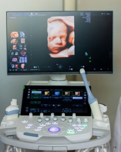 CHUK yahawe ‘Ultrasound' igezweho isuzuma ibibazo byose umwana uri mu nda afite