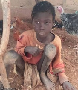 Polisi yatabaye umwana wari umaze imyaka 2 yicishwa inzara na se afatanyije n'abagore be