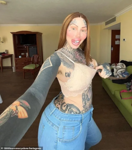 Umunyamideli yagabanyije amabere ye manini nyuma yo kuyongera rimwe rigaturika