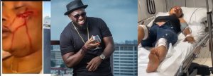 Timaya utegerejwe mu gitaramo i Kigali yahunze nyuma kugonga umukobwa agakomereka bikomeye 