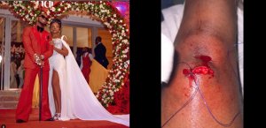 Zuchu umaze iminsi mu buryohe bw'urukundo na Diamond yakoze impanuka ikomeye [Video]