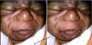 Umugore wabyaye umwana udafite uburanga yajyanywe mu nkiko n'umugabo we,amusaba akayabo k'impozamarira