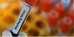 Rwanda: Abamaze guhitanwa n'icyorezo cya Marburg bageze ku 8