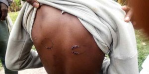 Karongi: Umugore arashinjwa guhohotera umwana we kugera ubwo amurumagura mu mugongo