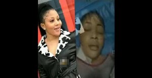 Umugore yaguye ku iseta amaze kwibagisha ashaka ubwiza bukurura abagabo