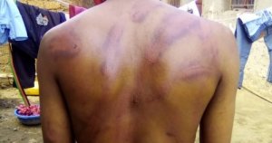 Musanze: Abaturage barataka inkoni zikabije bari gukubitwa n'abayobozi babo