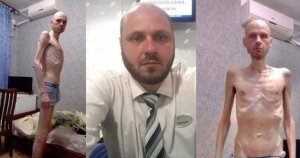 Umusirikare wa Ukraine yagaragaje akaga gakomeye yahuye nako nyuma yo gufungwa n'Abarusiya [AMAFOTO]