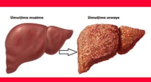 Dore ibintu 9 byangiza umwijima cyane abantu benshi batajya bitaho