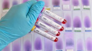 Rwanda: Abivuza indwara zandurira mu mibonano mpuzabitsina bariyongereye