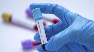 Habonetse abantu 26 banduye Coronavirus mu Rwanda hakira abandi 10