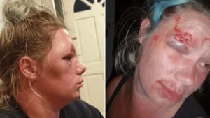 Umushoferi wa Taxi yakubise umugenzi aramukomeretsa amuziza kwibagirirwa telefoni ye mu modoka