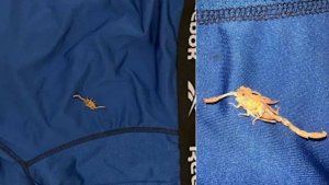 Umugabo amereye nabi Hoteli yarayemo akarumwa na sikorupiyo ku myanya y'ibanga