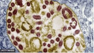 Imibare mishya ya Minisante yerekana ko abantu 300 bahuye n'abarwayi 26 ba Marburg