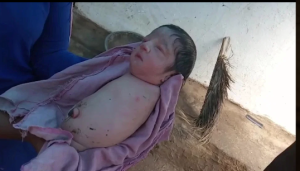 Umwana wavutse adafite amaguru n'amaboko yatumye isi yose igwa mu kantu [AMAFOTO]