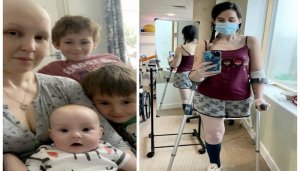 Yemeye gucibwa ukuguru kugira ngo arokore umwana yari atwite [AMAFOTO]