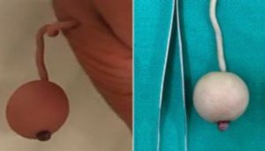 Umwana yaciye ibintu ku isi kubera umurizo utangaje yavukanye