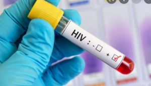 Bimwe mu bimenyetso bishobora kukwereka ko wanduye SIDA bitagusabye kwipimisha