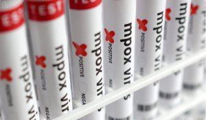 Umubare w'Abanyafurika bakekwaho Mpox watumbagiye ugera hafi 30 000