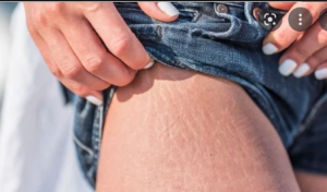 Menya uburyo wakoresha mu kugabanya amaribori mu gihe utayakunda cyangwa se akurya