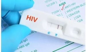 Abarenga ibihumbi 234 bafite Virusi itera Sida mu Rwanda: Urubyiruko rwaburiwe