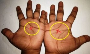 Niba ufite imirongo 3 mu kiganza cyawe aho kuba 4,reba icyo bisobanura[Amafoto]