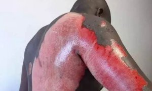 Umukozi wo muri hoteli yatwikishije shebuja amazi ashyushye