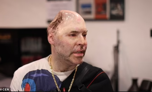 Umuraperi w'Umudage yatakarije igice cy'umutwe we mu iturika ryatewe n'urumogi yatekaga