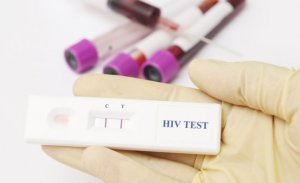 Umugore wa mbere ku isi yakize SIDA nyuma yo kumuvura mu buryo bwihariye