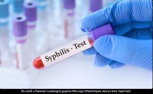 U Rwanda ruzatangira gupima Mburugu hifashishijwe uburyo bwa ‘rapid test' mu 2026