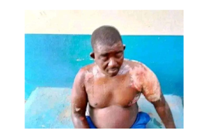 Umugore yamennye amazi ashyushye ku mugabo we bari bamaze amezi abiri gusa bashyingiranwe