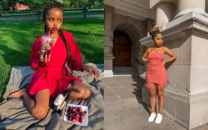 Ihere ijisho uburanga bw'umunyamideli w'imyaka 30 ufite isura igaragara nk'iyumwana [AMAFOTO]