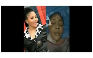 Yaguye ku iseta amaze kwibagisha ashaka ubwiza bukurura abagabo