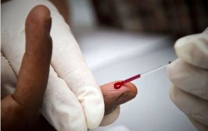 Ibimenyetso simusiga bizakwereka ko wanduye SIDA utabanje kujya kwisuzumisha