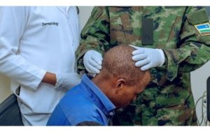 Rulindo: Abarenga ibihumbi 10 bagiye kuvurwa n'Ingabo z'u Rwanda ku buntu