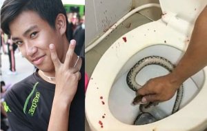 Inzoka yarumye umusore igitsina ubwo yari yicaye ku musarani[AMAFOTO]