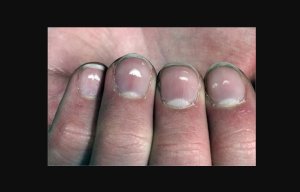 Sobanukirwa byinshi ku tubara tw'umweru tuza mu nzara tuzwi nk'INONO