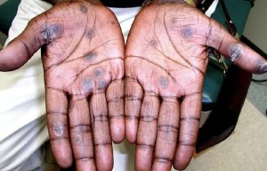 Mburugu imeze nabi mu Budage