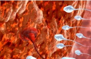 EVERHEALTHY:Umuti uzwiho gusubiza icyubahiro Abago mu ngo zabo