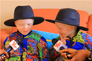 Wa mubyeyi wabyaye abana bafite ubumuga bw'uruhu yahishuye urugendo rw'ubuzima bwabo n'ibyabagoye