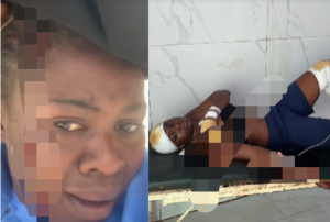 Yakoze impanuka aho kwita ku kwivuza yifata amashusho avirirana ayashyira kuri Tik Tok