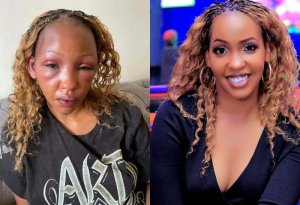 Sandra Teta yahishuye abamukubise bakamugira intere batari umukunzi we Weasel