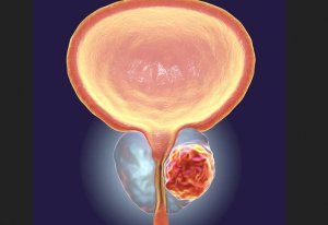 Abagabo: Ibimenyetso 11 byakumenyesha ko urwaye Prostate