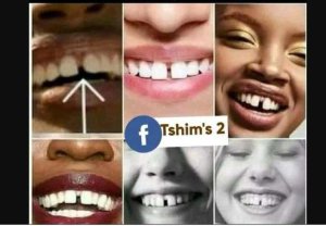 Sobanukirwa byinshi bijyanye n'inyinya n'uko abazifite bitwara