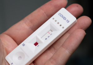 Agakoresho gakoreshwa mu gupima byihuse Covid-19 kari gukwirakwizwa ku isi kuri 4,800 FRW