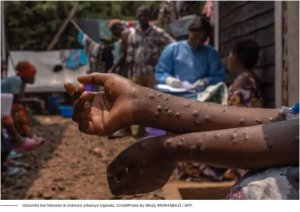 Uganda: Ubushita Bw'Inkende Buraca Ibintu
