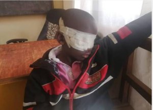 Bunia :Umwana w'imyaka 9 yahohotewe akurwamo amaso akekwamo amashitani