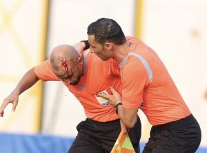 Tunisie: Umusifuzi waketsweho kubogama yakomerekejwe n'abafana